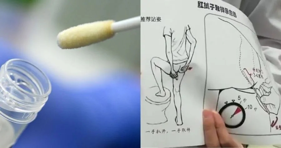 Jak zrobić wymaz z odbytu dziecku - krok po kroku bez stresu